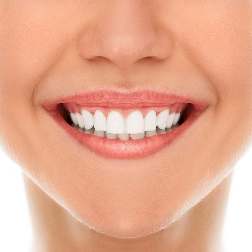 Diş Beyazlatma