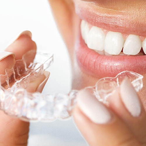 Şeffaf Plak Tedavisi